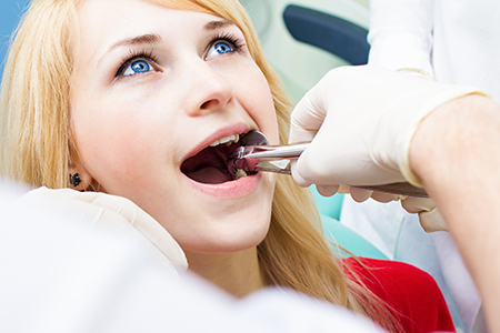Summit Family Dentistry | Crowns, Dental Cleanings and Dental Fillings