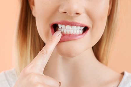 Summit Family Dentistry | Dental Bridges, Fluoride Treatment and Dental Cleanings